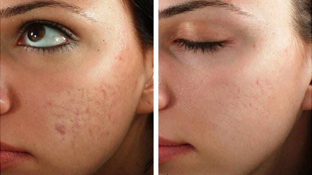 dermatologue maroc